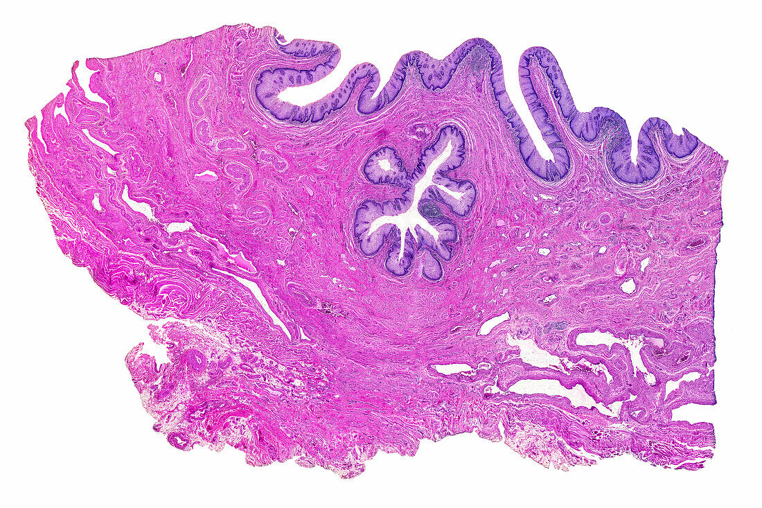 Human urethra, light micrograph