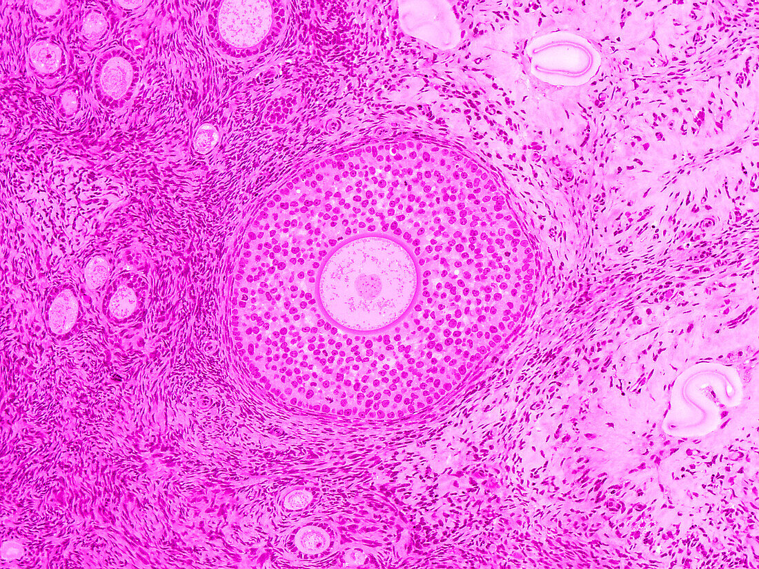 Monkey ovary, light micrograph
