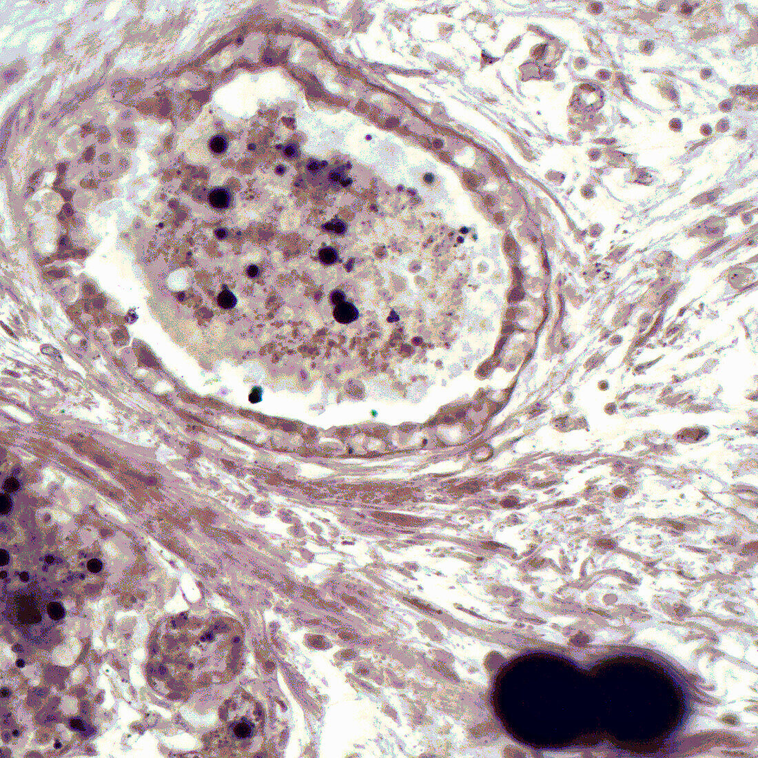 Lactating human mammary gland, light micrograph