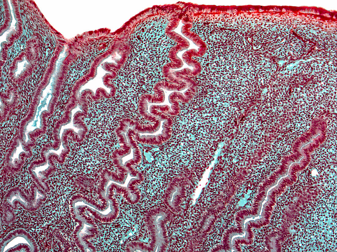 Human uterus, light micrograph