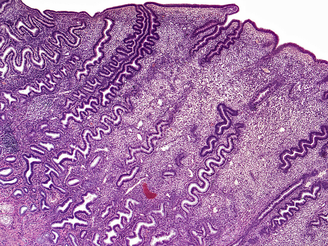 Human uterus, light micrograph