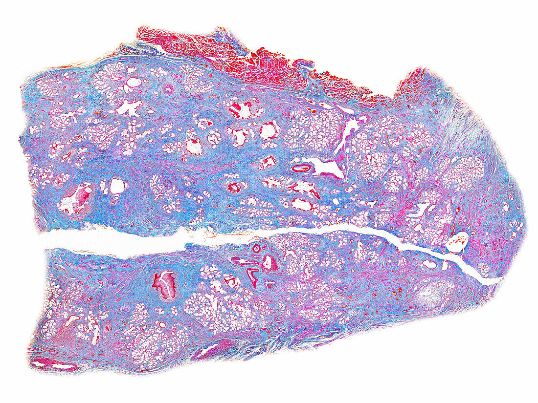 Human Bartholin's gland, light micrograph