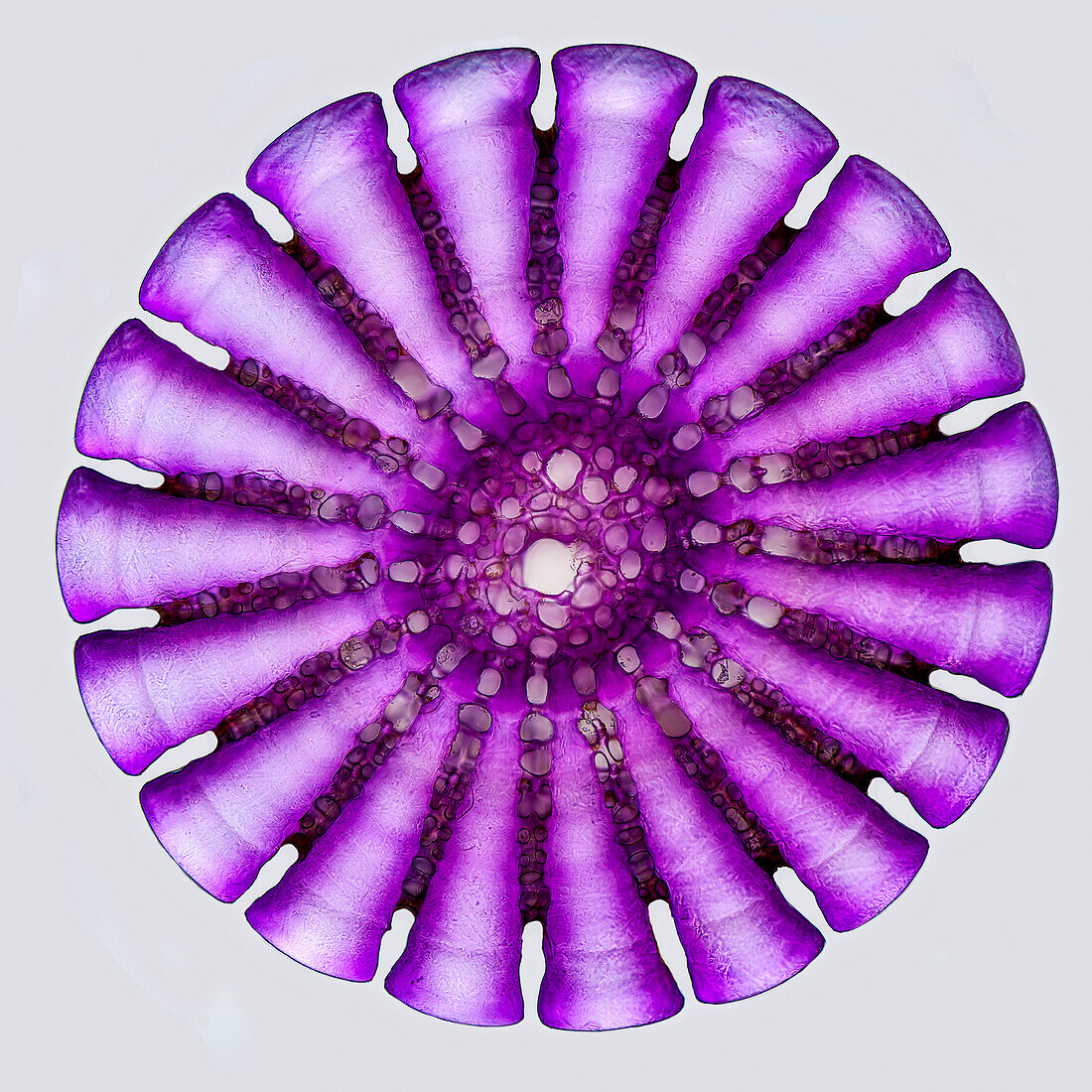 Sea urchin spine, light micrograph
