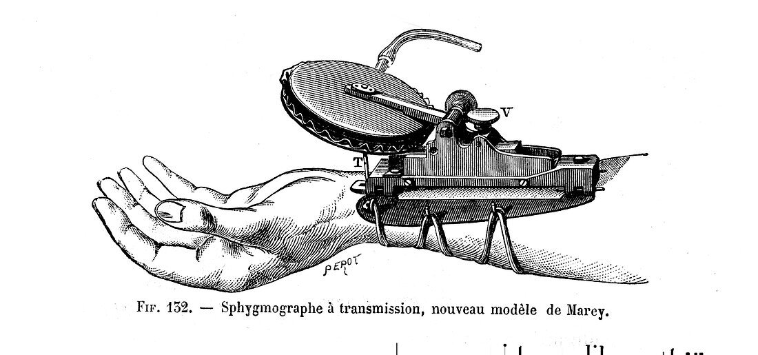 Marey's sphygmograph, 19th century illustration