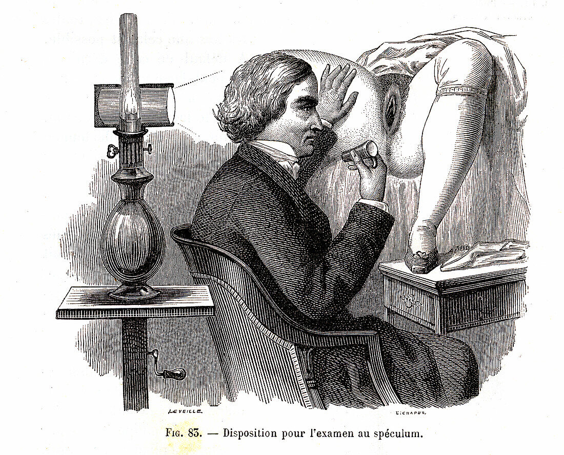 Examination using a vaginal speculum, illustration