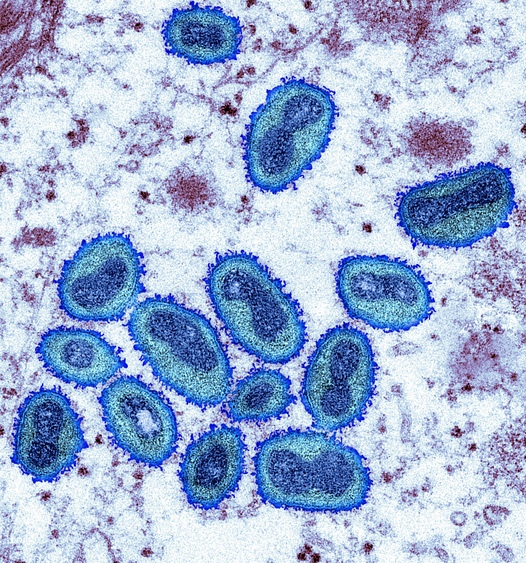 Monkeypox virus particles, TEM