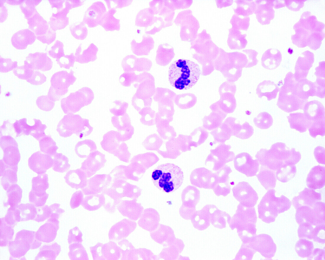 Human blood smear with neutrophils, light micrograph