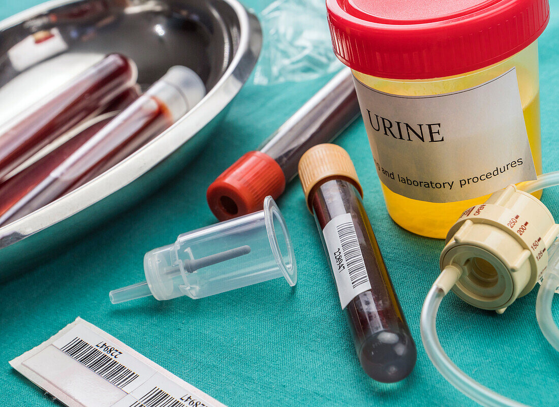 Urine and blood samples at hospital table, conceptual image