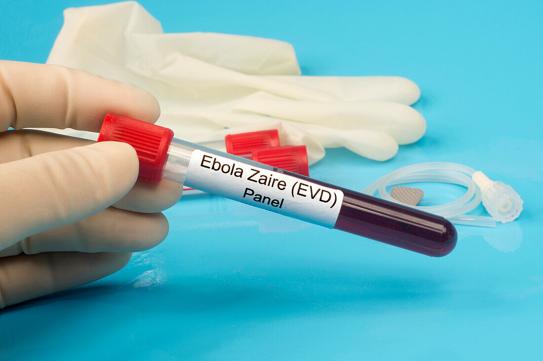 Ebola lab panel