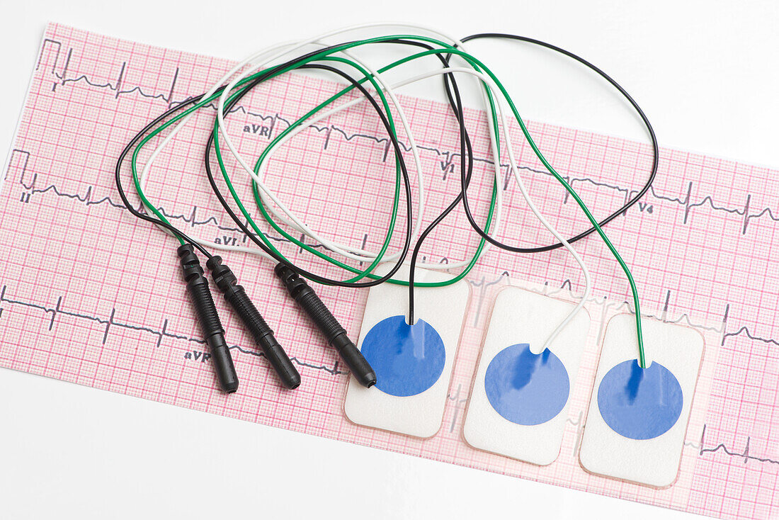 Electrocardiogram leads