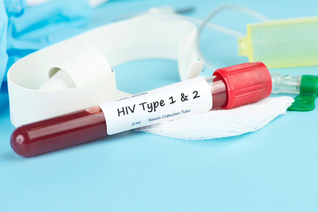 HIV type 1 and 2