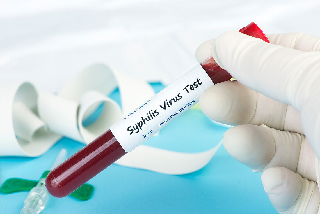 Syphilis blood test