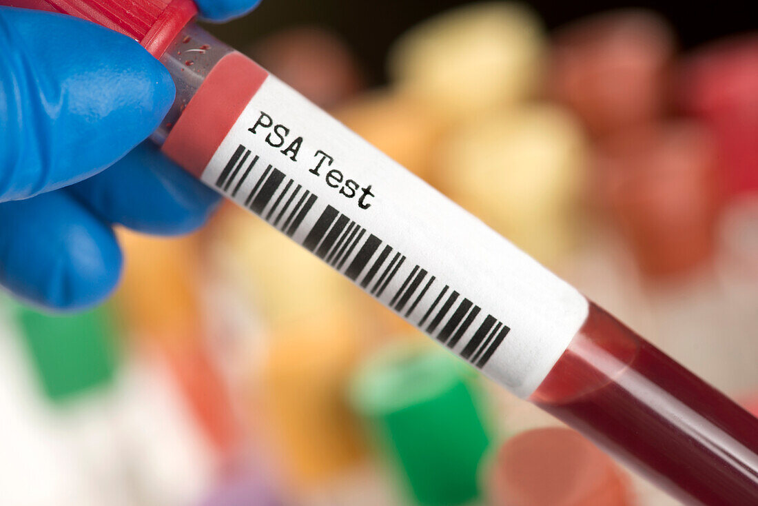PSA blood test tube