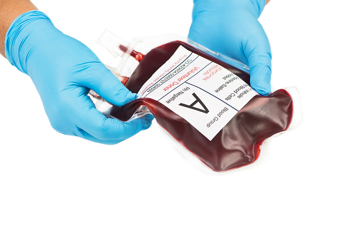 Type A donated blood unit