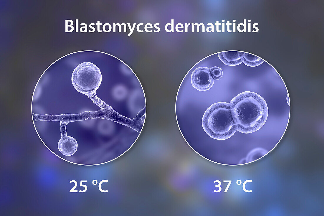 Blastomyces fungus, illustration