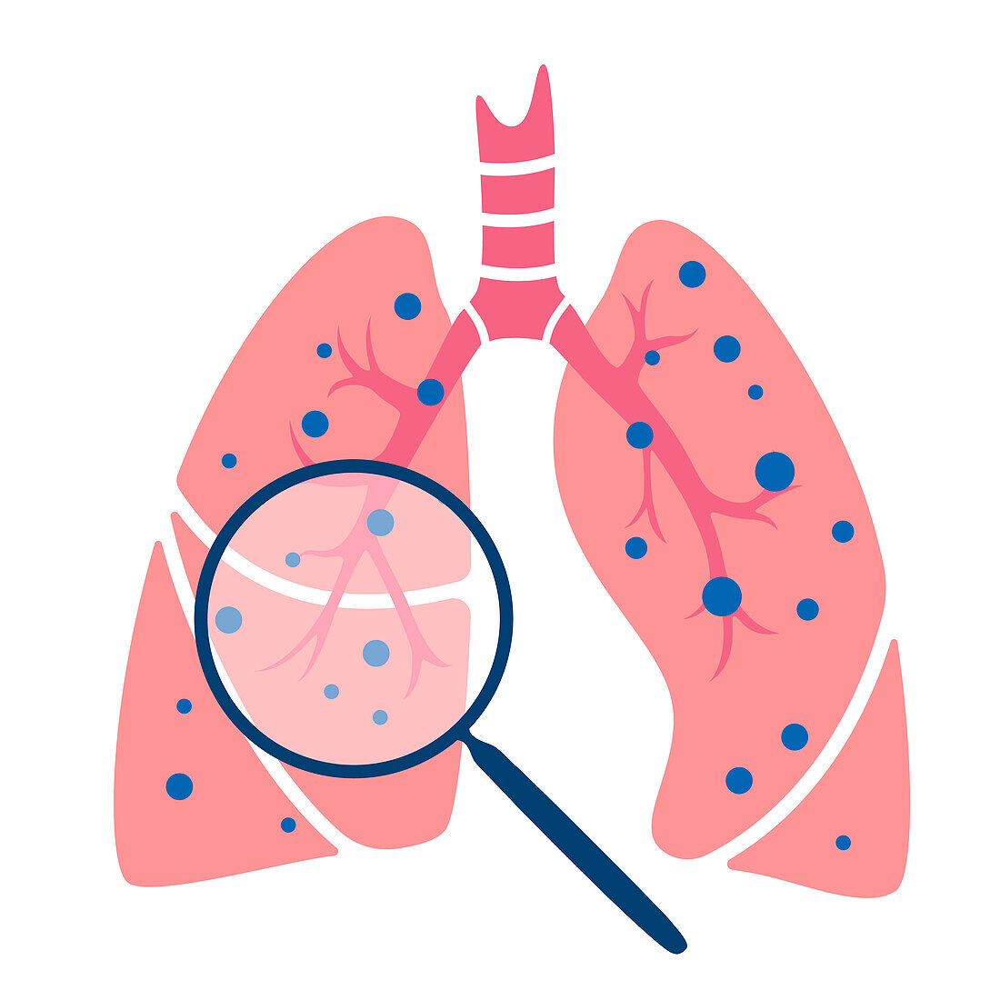 Lung disease, conceptual illustration
