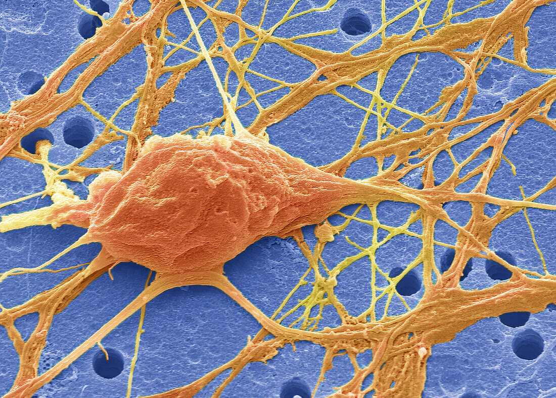 Pluripotent derived neurones, SEM