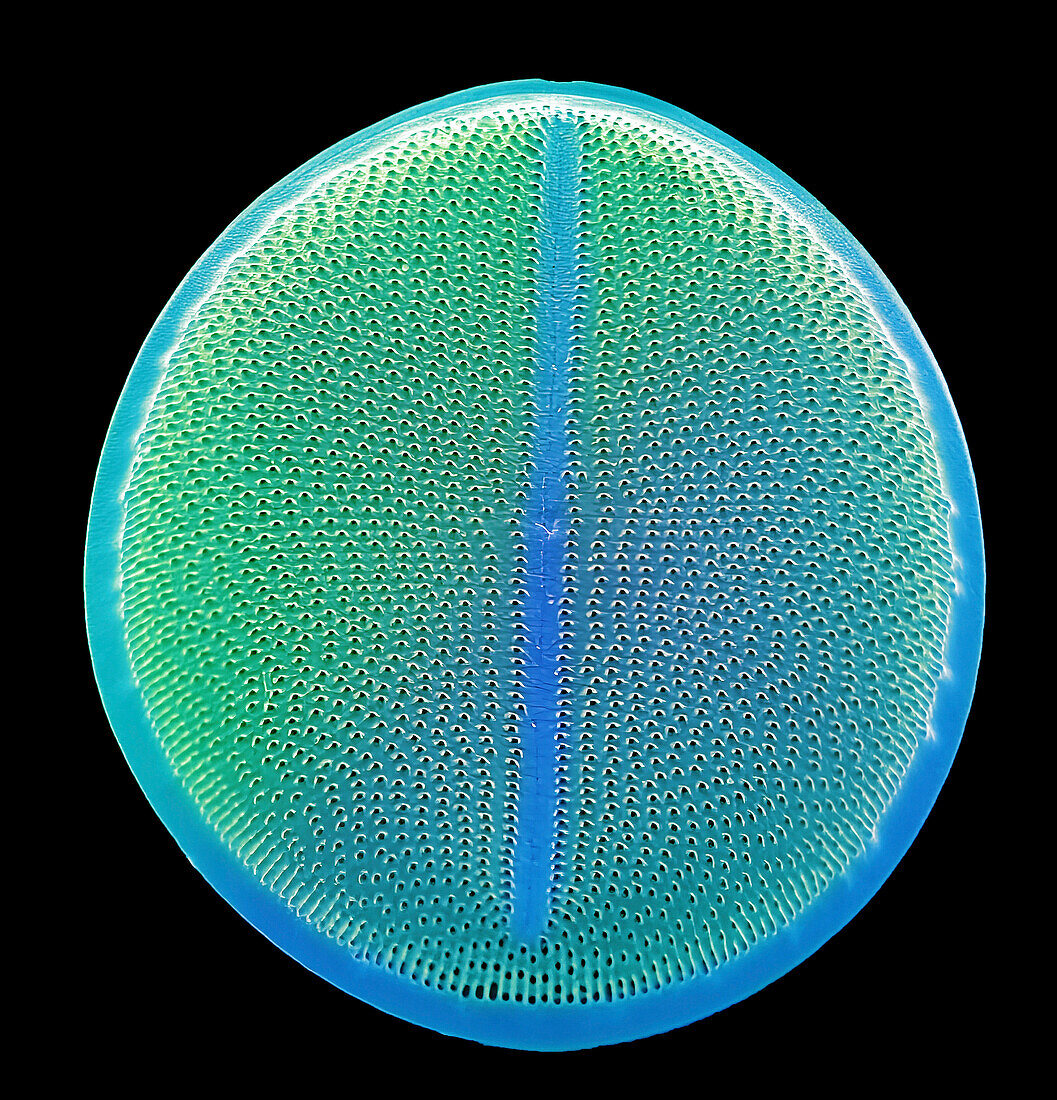 Diatom, SEM