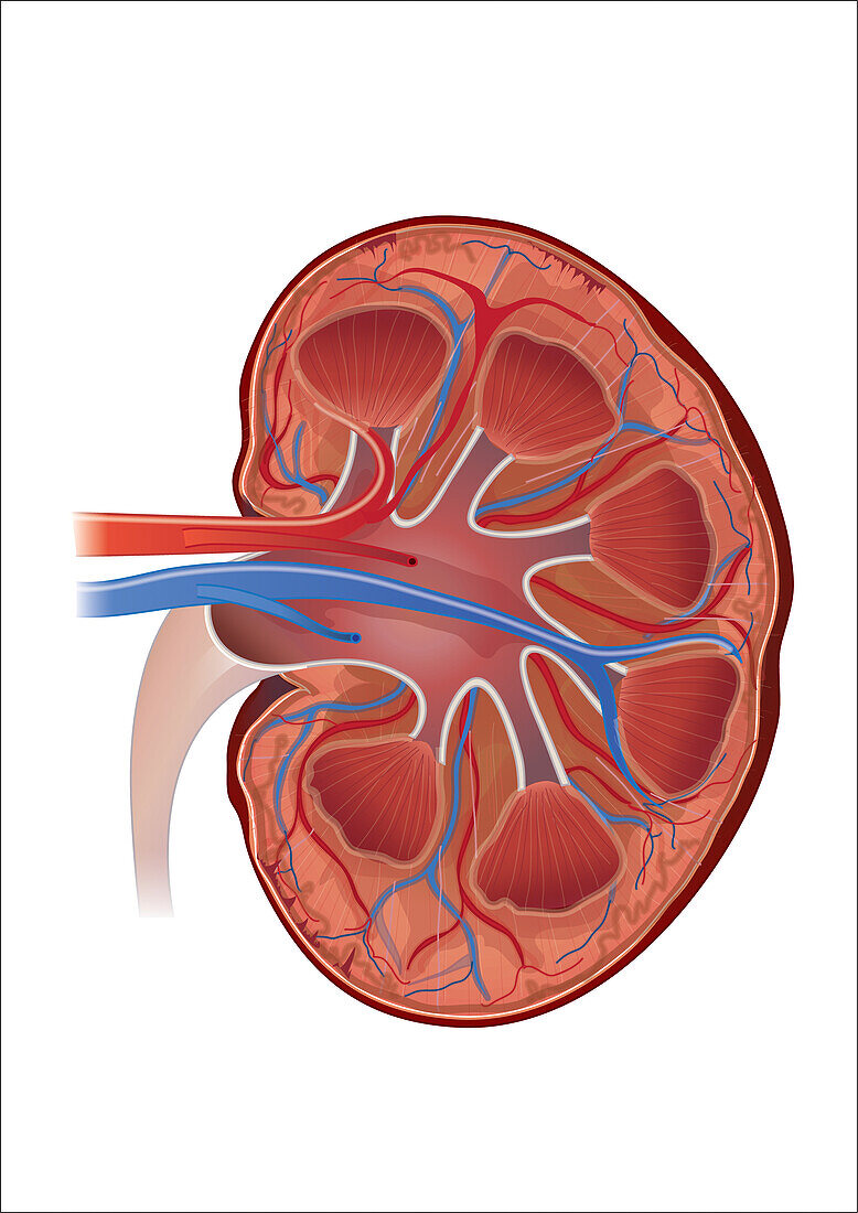 Cat kidney with hypertension, illustration