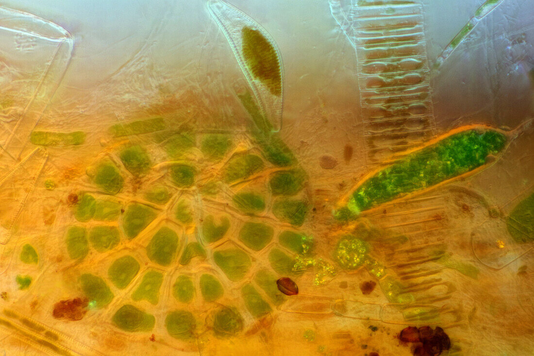 Phycopeltis alga and diatoms, light micrograph