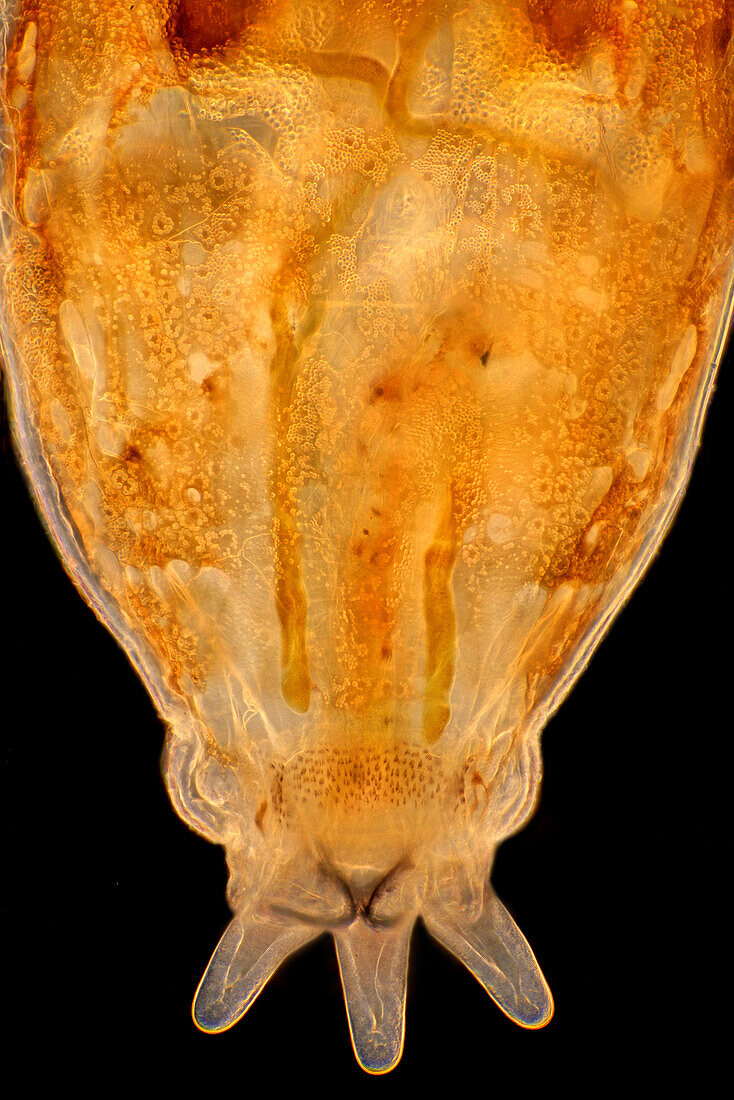 Blackfly larva suction disc, light micrograph