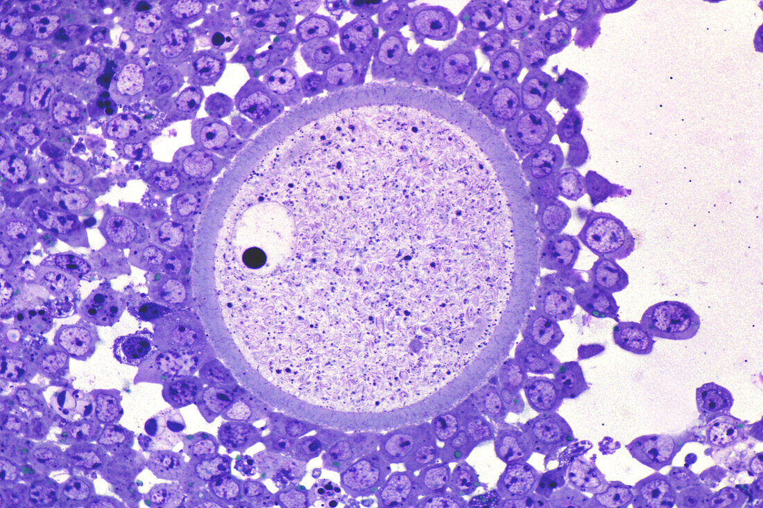Primary oocyte, light micrograph