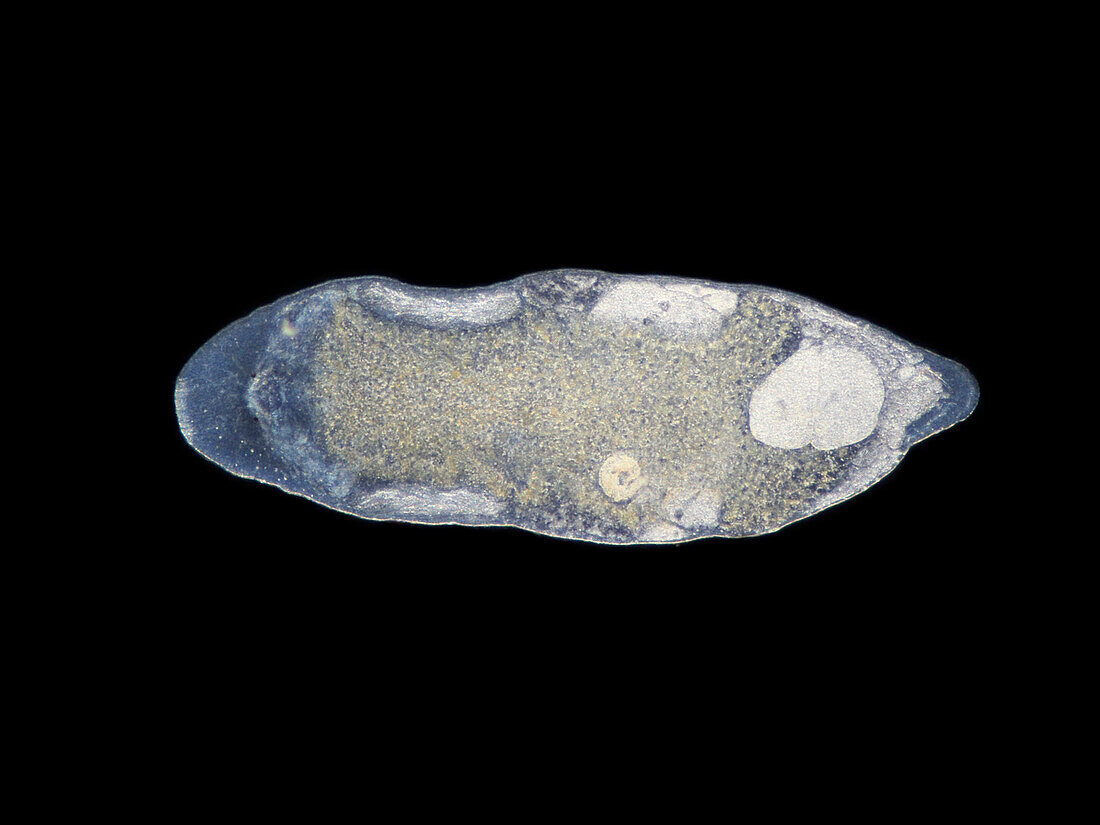 Flatworm, light micrograph