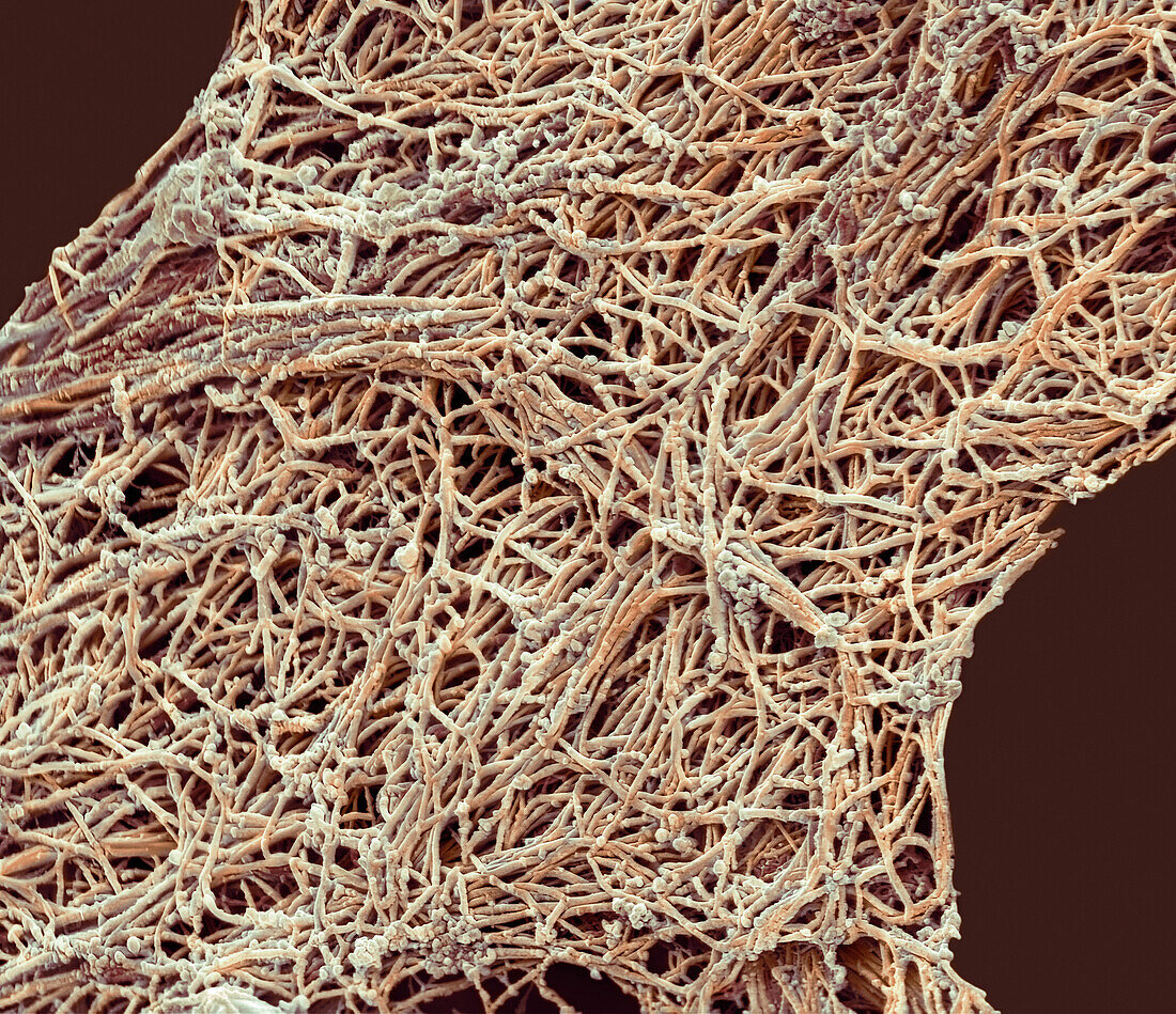 Collagen fibres, SEM