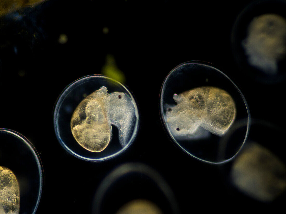 Water snail, light micrograph