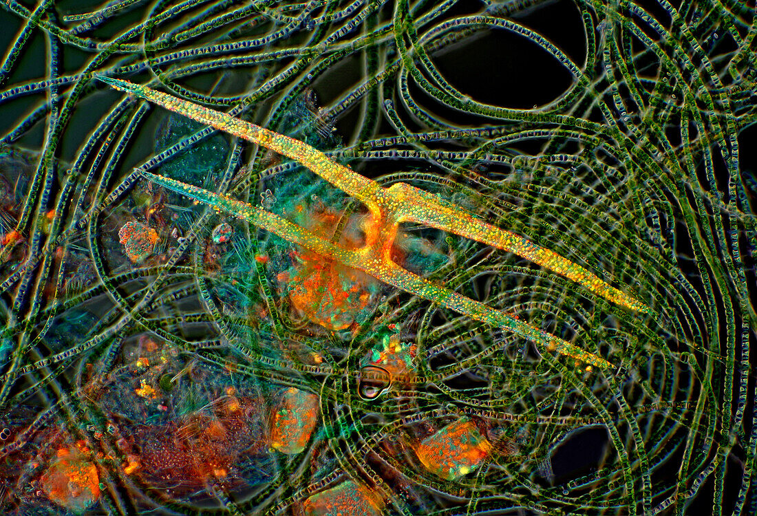 Sponge spicule among algae and mineral gra, light micrograph