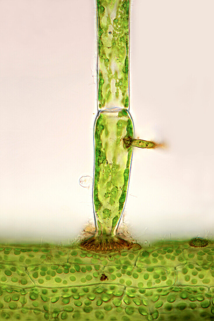 Green alga on an aquatic plant, light micrograph