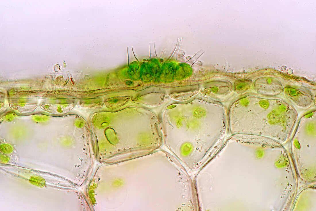 Green algae on aquatic plant stalk, light micrograph
