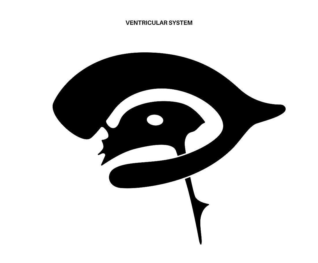 Ventricular system, illustration