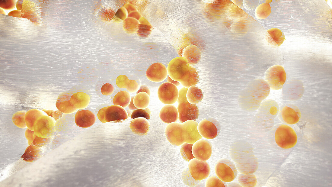 Staphylococcus bacteria biofilm, illustration