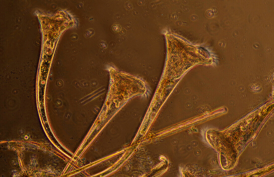 Stentor ciliate, light micrograph