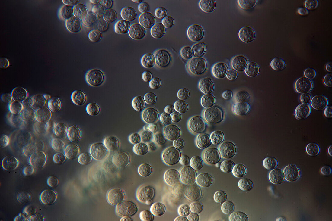 Yeast, light micrograph
