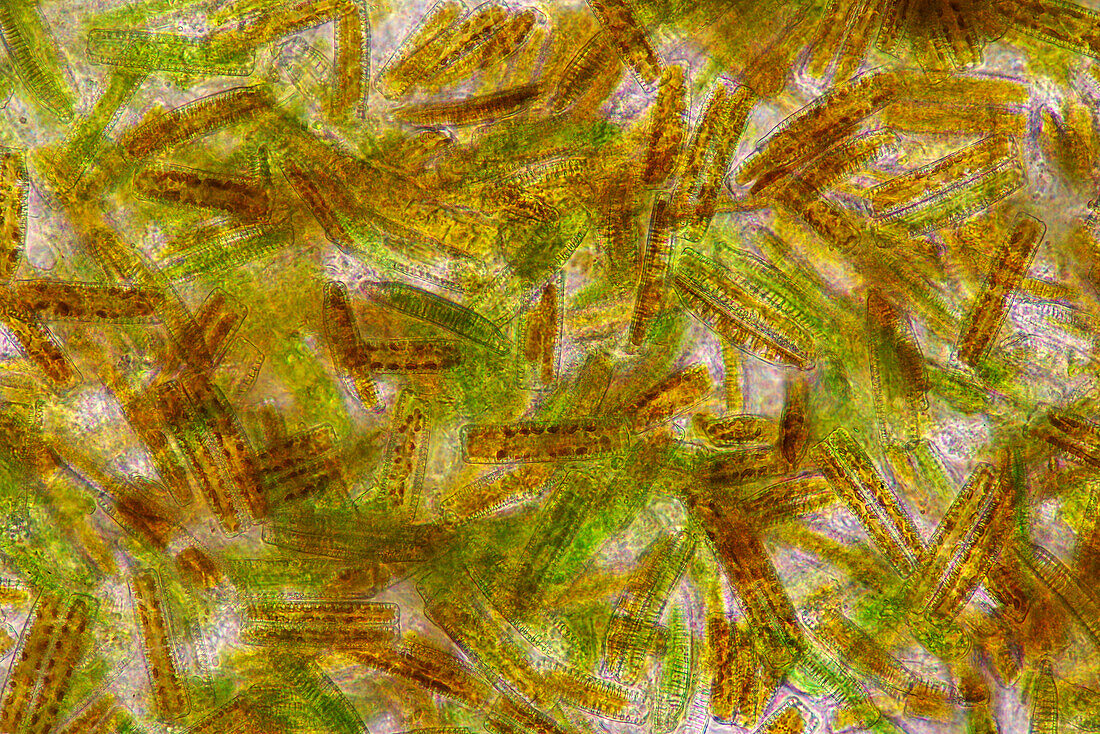 Epithemia diatoms, light micrograph