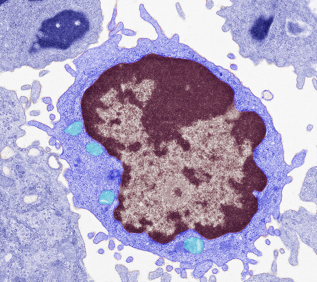 Large lymphocyte, TEM