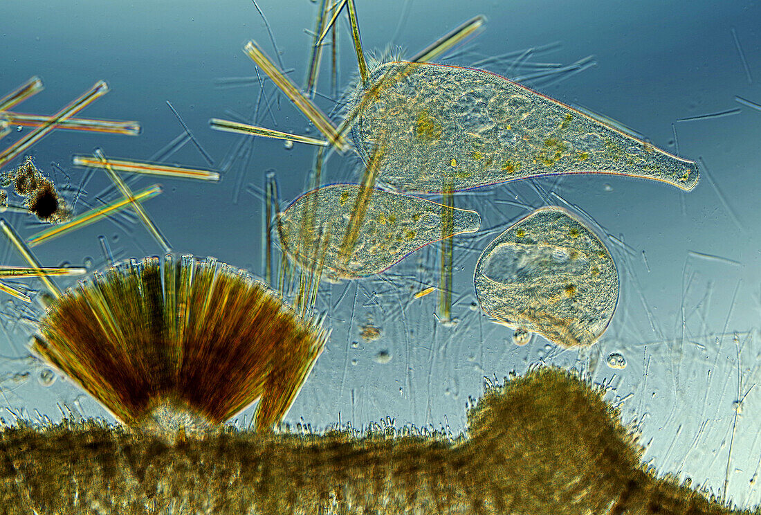 Stentor ciliates, light micrograph