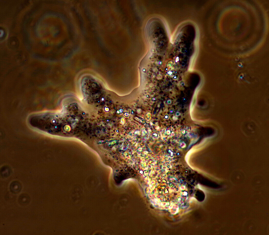 Amoeba, light micrograph