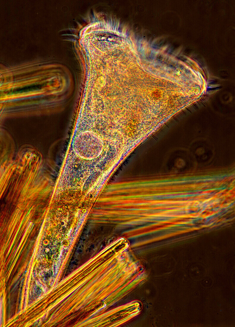 Stentor ciliate and diatoms, light micrograph