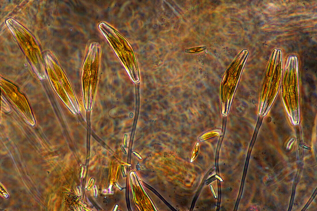 Cymbella sp. diatoms, light micrograph