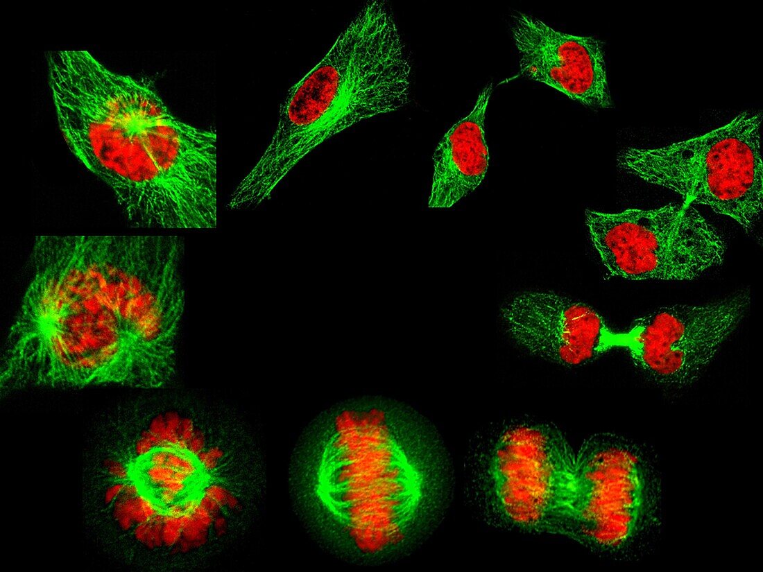 Human cells showing the stages of cell division, light micrograph