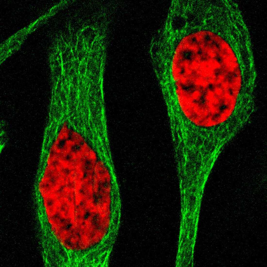 Two human cells in interphase, light micrograph