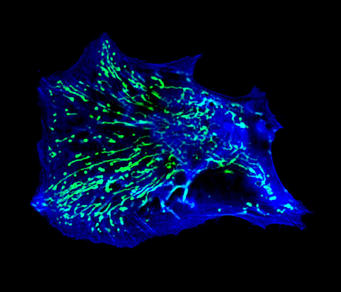 Human fibroblast cells, light micrograph