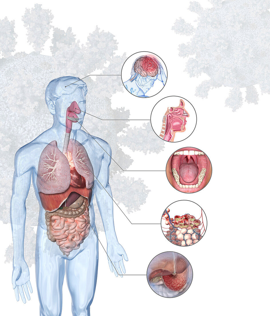 Symptoms of coronavirus infection, illustration
