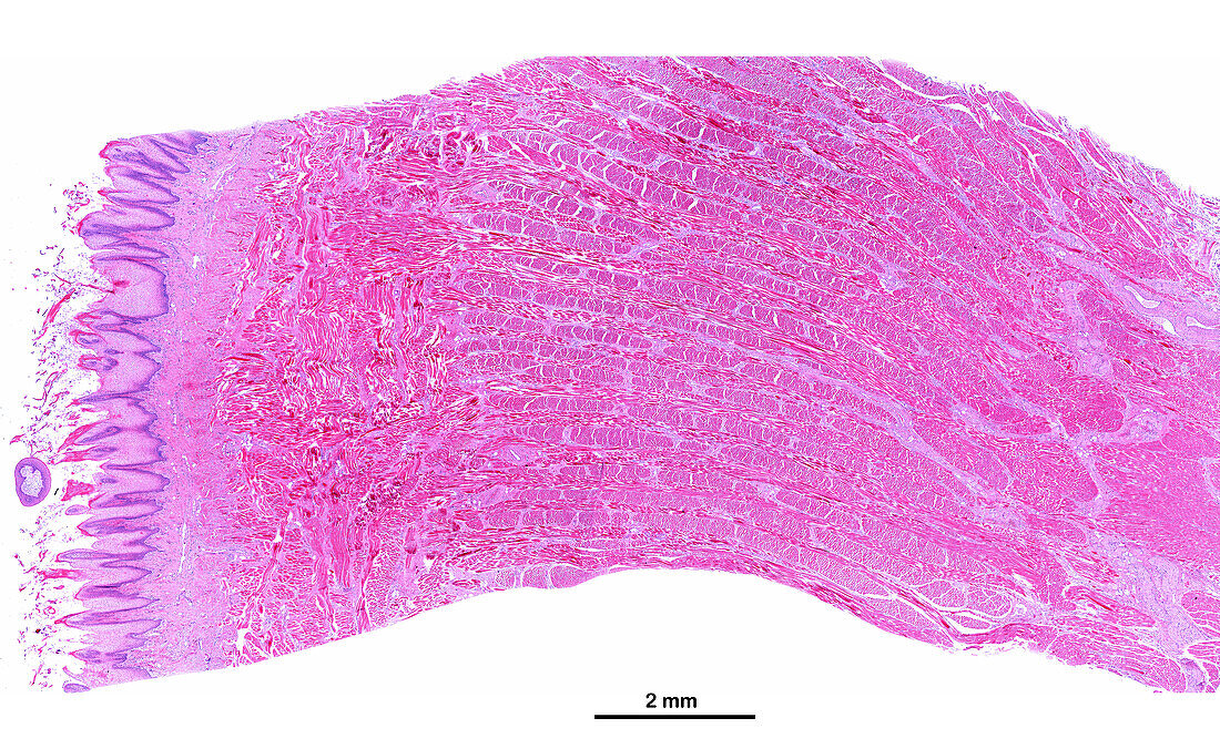 Filiform papillae, light micrograph