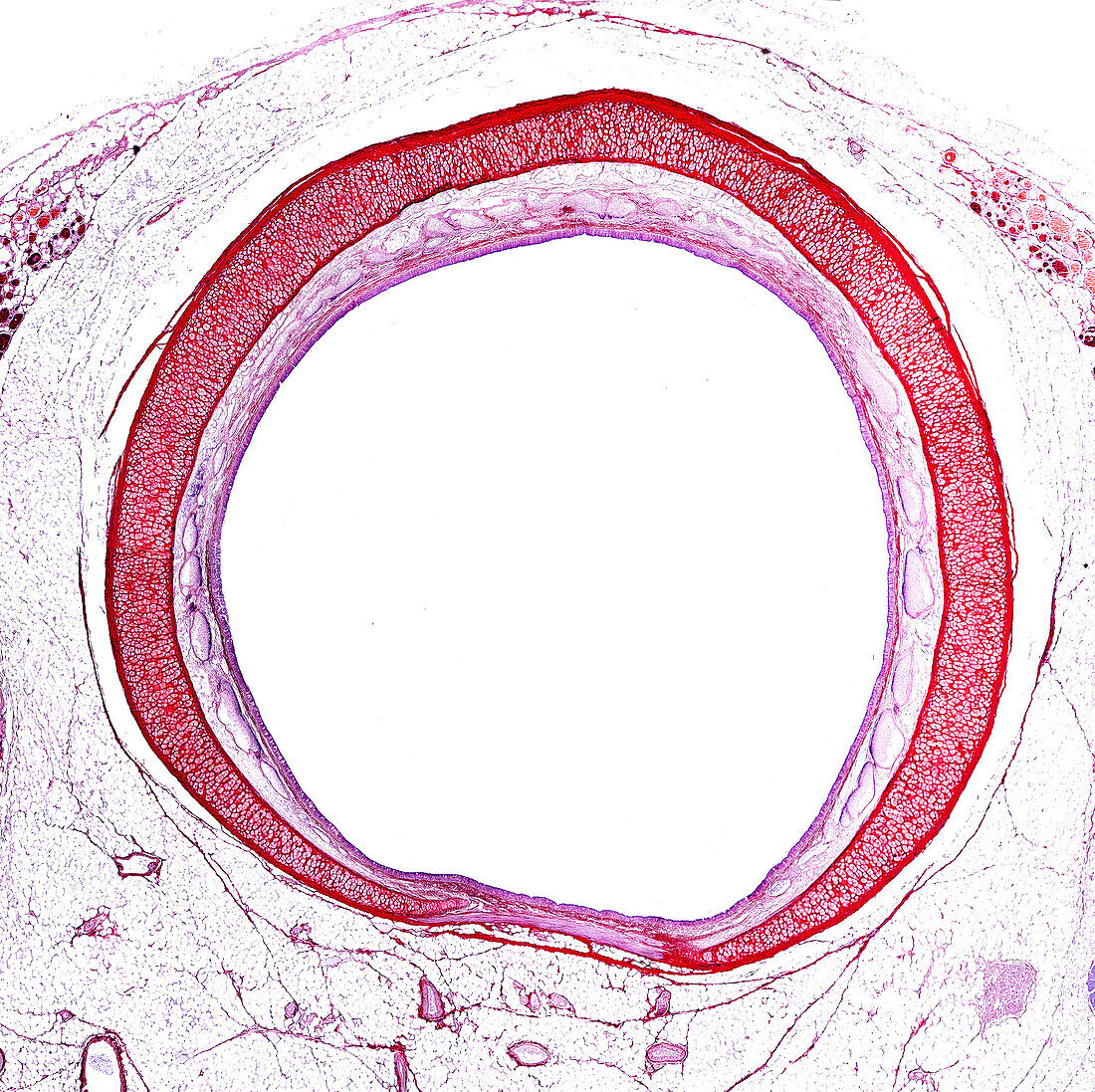 Trachea, light micrograph