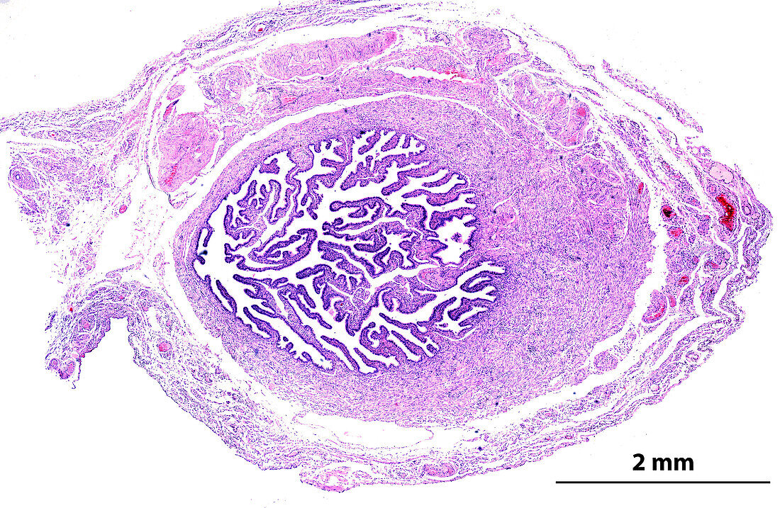Human fallopian tube, light micrograph