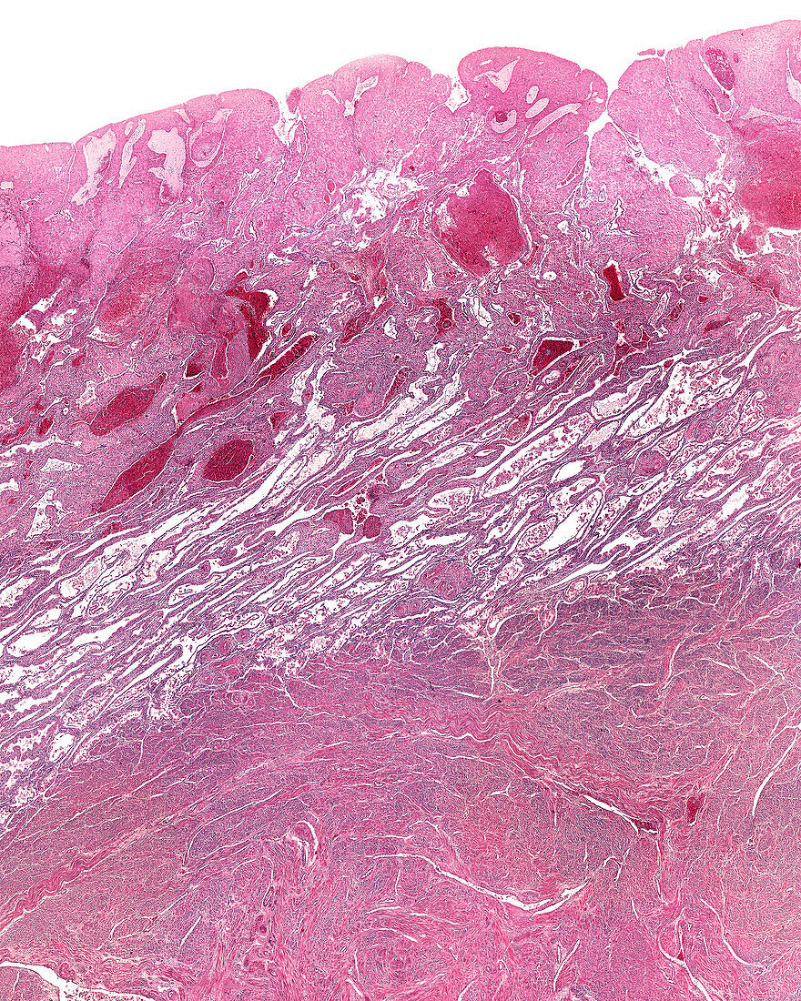 Human uterus in pregnancy, light micrograph